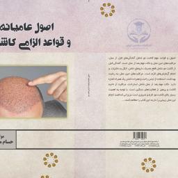 اصول عامیانه و قواعد الزامی کاشت مو